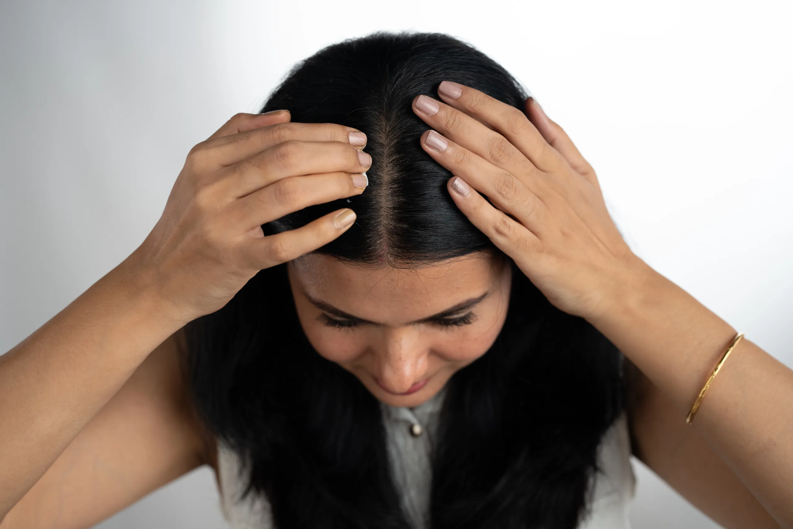 Natural ingredients for hair loss