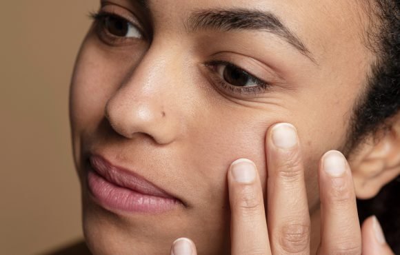 How to Get Rid of Dark Circles Naturally