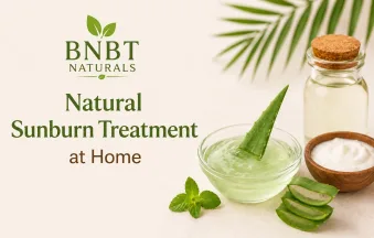 Natural Sunburn Treatment at Home