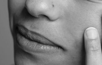 How Stress Affects Your Skin