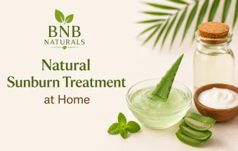 Natural Sunburn Treatment at Home